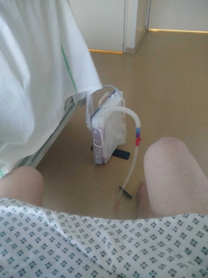 I'm in hospital and I had emergency surgery. Guess what part of my body the tube is stuck in.