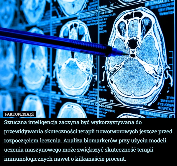 Sztuczna inteligencja zaczyna być wykorzystywana do przewidywania skuteczności