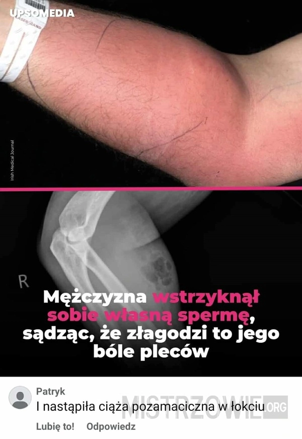 
    Sposób na ból pleców