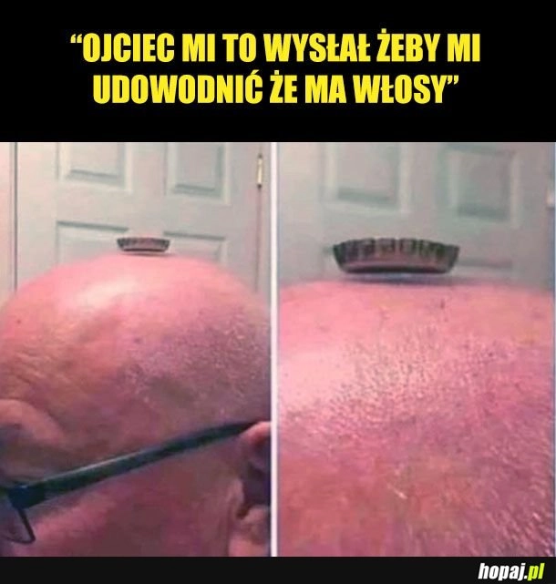 Włosy