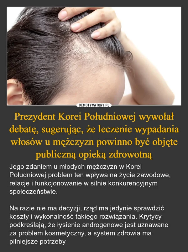 
    Prezydent Korei Południowej wywołał debatę, sugerując, że leczenie wypadania włosów u mężczyzn powinno być objęte publiczną opieką zdrowotną