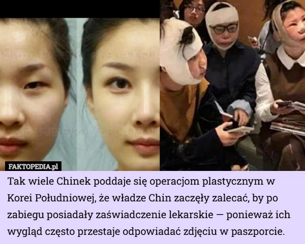 
    Tak wiele Chinek poddaje się operacjom plastycznym w Korei Południowej...