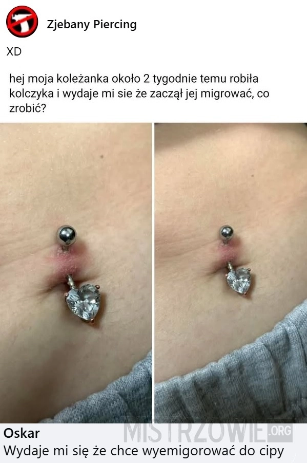 
    Kolczyk
