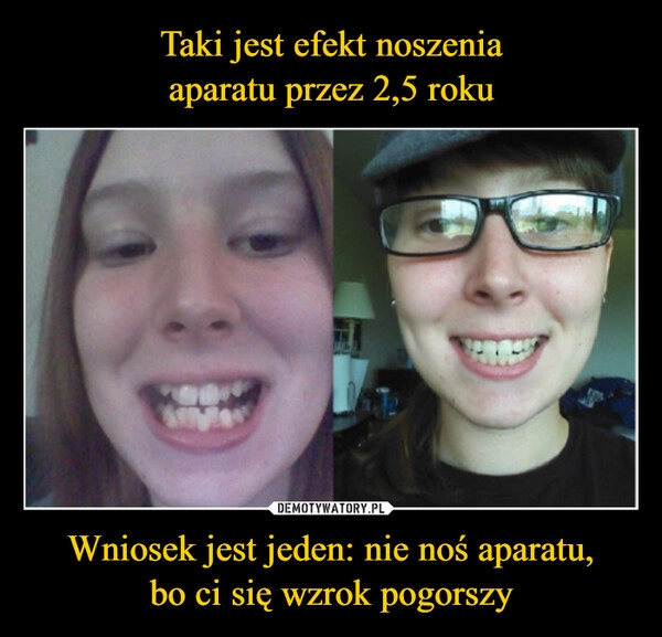 
    Taki jest efekt noszenia
aparatu przez 2,5 roku Wniosek jest jeden: nie noś aparatu,
bo ci się wzrok pogorszy