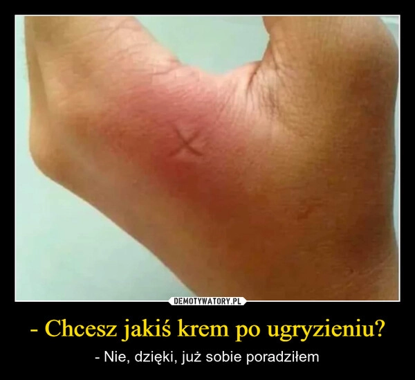 
    - Chcesz jakiś krem po ugryzieniu?